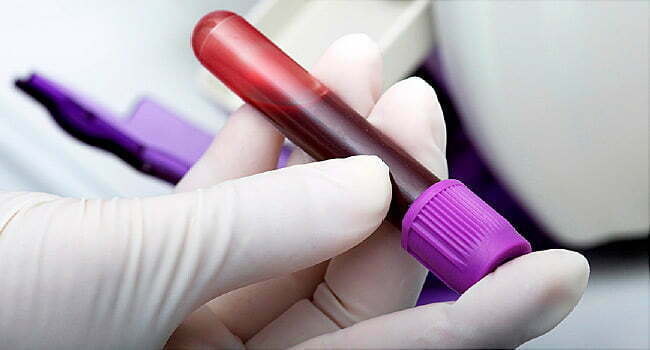 Cancer Survivors May Have Lower Odds for Dementia 1