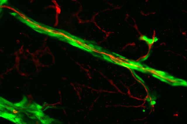 Roche's Genentech goals cancer cells thru video game with Tumor Quest 1