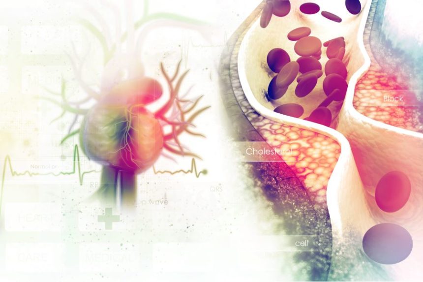 Hypertension, low HDL increase macrovascular risk in type 1 diabetes