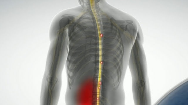 Seven of the biggest again pain myths, according to a physiotherapist