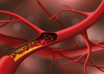 Best Diet To Lower Cholesterol 