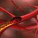 Best Diet To Lower Cholesterol 